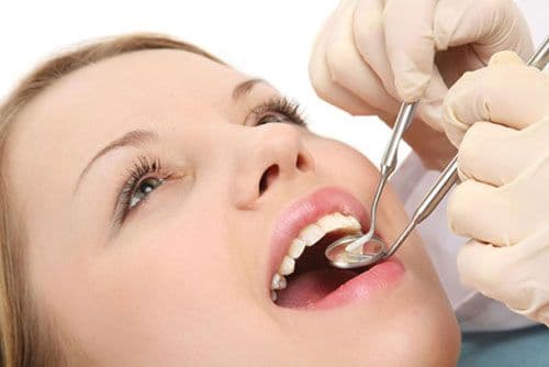Professional Dental Scaling