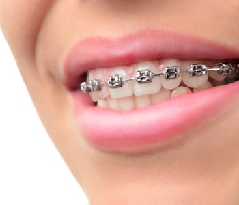 Orthodontic Rx