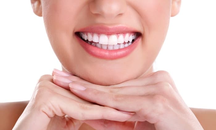 Teeth Whitening