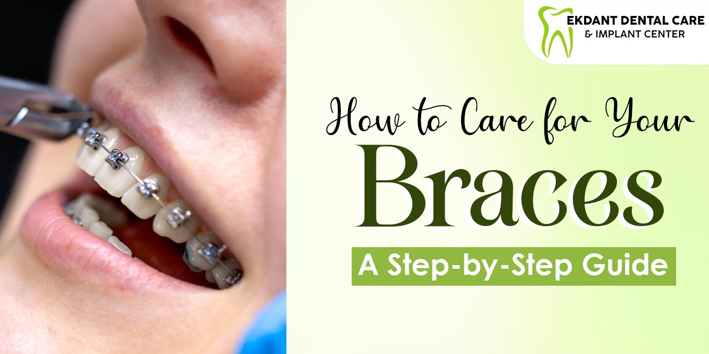 Care for Your Braces
