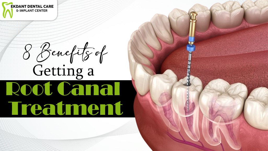 Root Canal Treatment in Sangavi